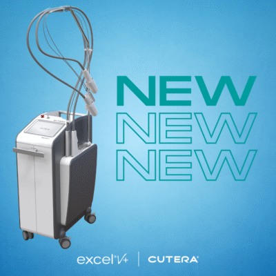 Excel V+ treatment at Palisades Vein Center NYC